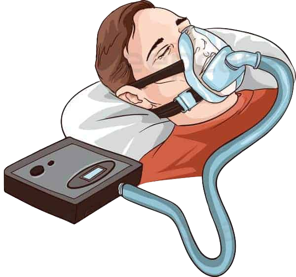 Traitement par PPC ( CPAP )